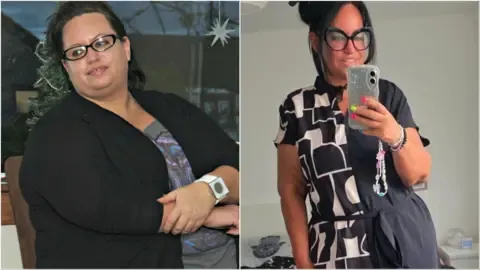 They Dropped Pounds Using Shots – Arrived the Sagging Skin